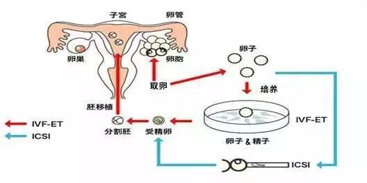 烟台助孕中心